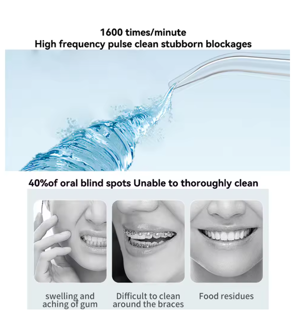 Oral Irrigator – Find Your Beauty